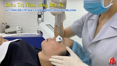 Phương pháp trị nám da mặt tiên tiến bằng Laser tại Gia Lai